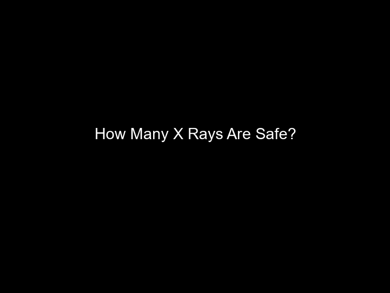 How Many X Rays Are Safe?