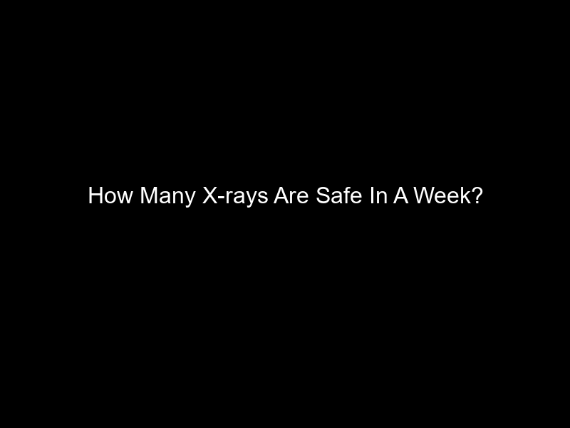 How Many X-rays Are Safe In A Week?